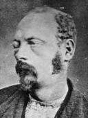 Cole Younger (1844-1916) nach der Verhaftung in 1876